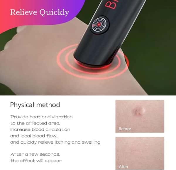 Mosquito Bite Helper – Insect Bite Relief